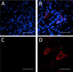 Purified anti-α Smooth Muscle Actin Antibody (614851)