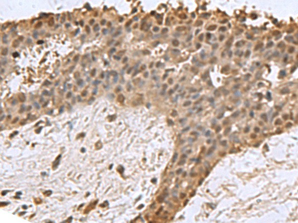 DCTPP1 Polyclonal Antibody (E-AB-19139)