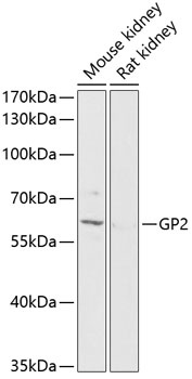 GP2 Polyclonal Antibody (E-AB-90418)