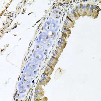 ERBB4 Polyclonal Antibody (E-AB-62732)