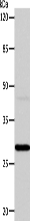 CA1 Polyclonal Antibody (E-AB-13965)