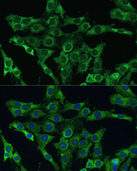PLSCR3 Polyclonal Antibody (E-AB-63692)
