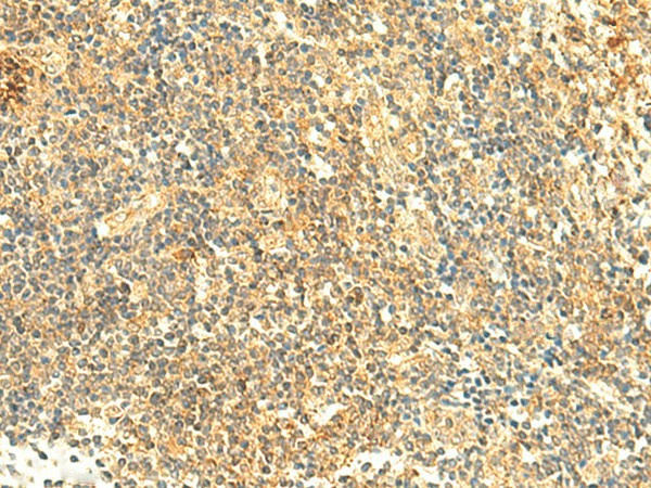 ARL4D Polyclonal Antibody (E-AB-18936)