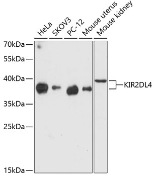 KIR2DL4 Polyclonal Antibody (E-AB-64343)