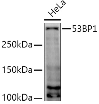 53BP1 Polyclonal Antibody (E-AB-68380)