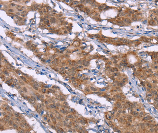 Histamine H3 Receptor Polyclonal Antibody (E-AB-16494)
