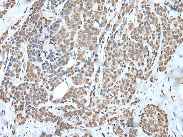 WTAP Polyclonal Antibody (E-AB-52415)