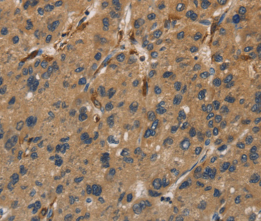 UBE2S Polyclonal Antibody (E-AB-14967)