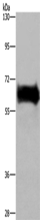 EZR Polyclonal Antibody (E-AB-15004)