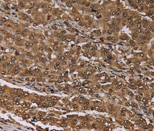 MEIS1 Polyclonal Antibody (E-AB-13408)