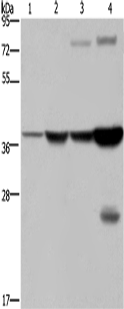 FBP1 Polyclonal Antibody (E-AB-15024)