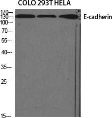 E-Cadherin Polyclonal Antibody (E-AB-31261)
