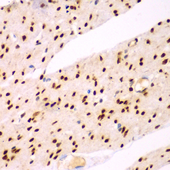 TEAD3 Polyclonal Antibody (E-AB-61715)