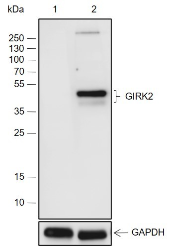 Recombinant GIRK2 Monoclonal Antibody (AN301972L)