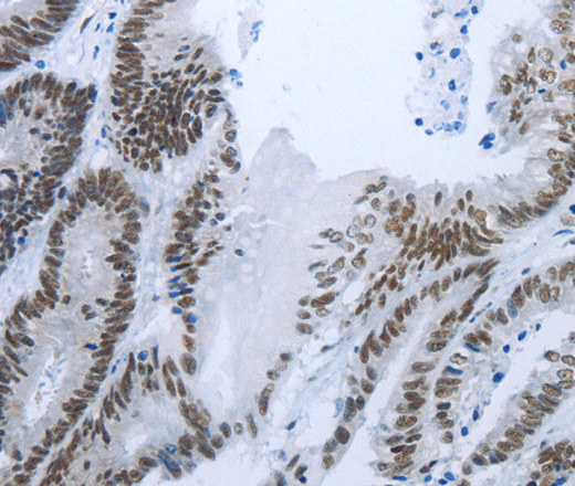 RBMS1 Polyclonal Antibody (E-AB-15836)