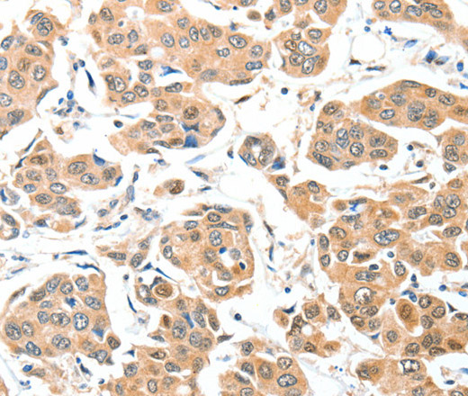 ADCK1 Polyclonal Antibody (E-AB-14508)
