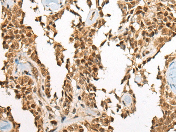 ATE1 Polyclonal Antibody (E-AB-19608)