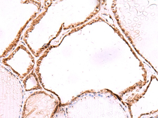 LMCD1 Polyclonal Antibody (E-AB-52912)