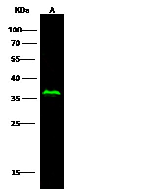 Recombinant RRM2B/P53R2 Monoclonal Antibody (AN300434P)