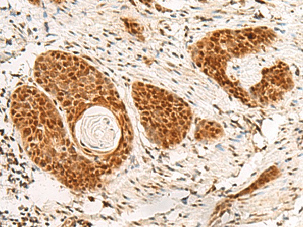 POM121 Polyclonal Antibody (E-AB-18876)