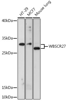 WBSCR27 Polyclonal Antibody (E-AB-66713)
