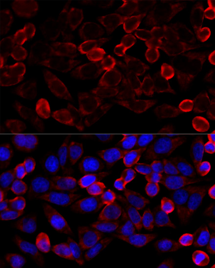 HDAC6 Polyclonal Antibody (E-AB-63502)