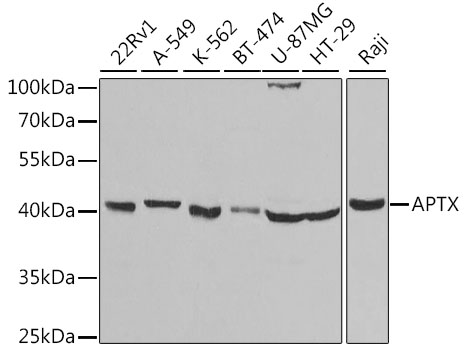 APTX Polyclonal Antibody (E-AB-60928)