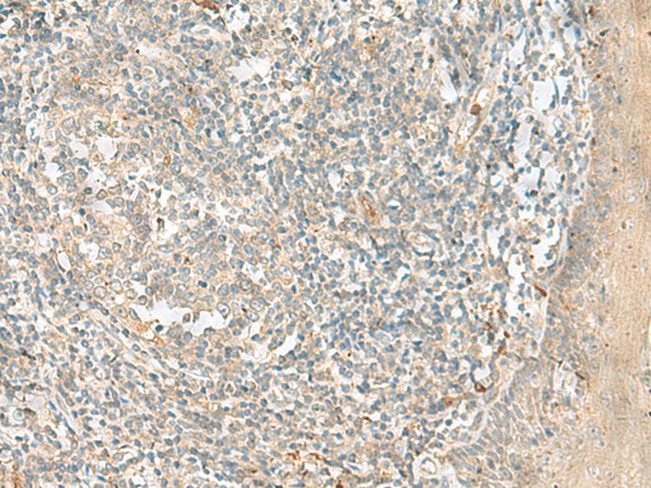 TTLL1 Polyclonal Antibody (E-AB-52744)