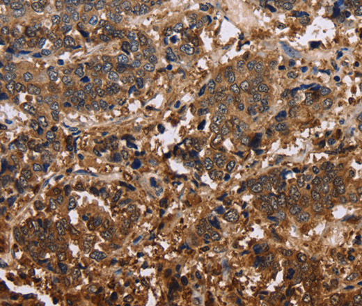 FBP2 Polyclonal Antibody (E-AB-15025)