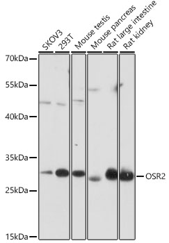 OSR2 Polyclonal Antibody (E-AB-91987)
