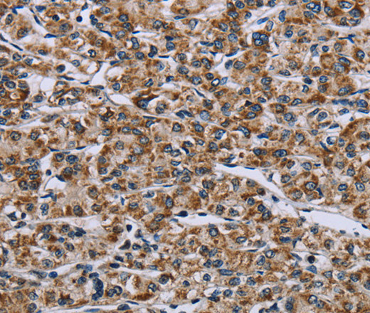 GTPBP10 Polyclonal Antibody (E-AB-15089)