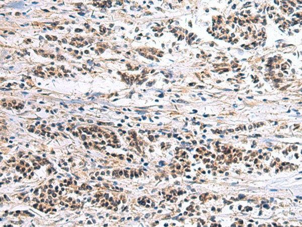 CLCN7 Polyclonal Antibody (E-AB-52548)