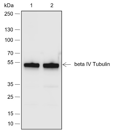 Recombinant beta IV Tubulin Monoclonal Antibody (AN301941L)