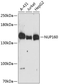 NUP160 Polyclonal Antibody (E-AB-64444)