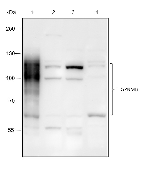 Recombinant GPNMB Monoclonal Antibody (AN301540L)