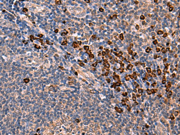 INSM2 Polyclonal Antibody (E-AB-52028)