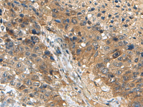 TPD52L3 Polyclonal Antibody (E-AB-53036)