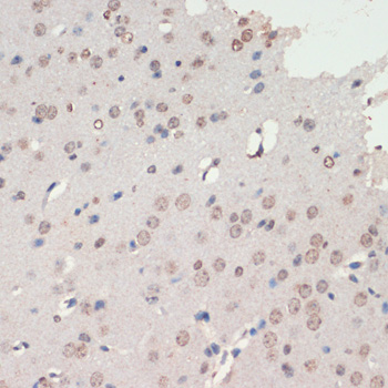 NEUROD1 Polyclonal Antibody (E-AB-66989)