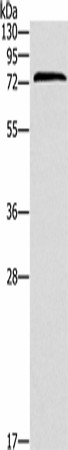 ZAP70 Polyclonal Antibody (E-AB-53219)