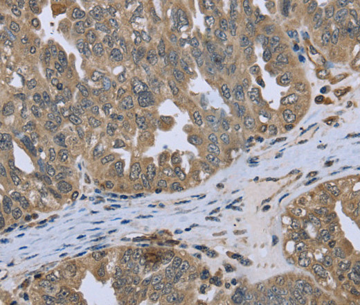 DCTN4 Polyclonal Antibody (E-AB-11145)