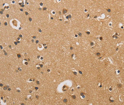 CST6 Polyclonal Antibody (E-AB-14922)