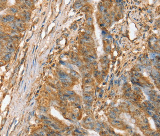 SLC41A2 Polyclonal Antibody (E-AB-13648)
