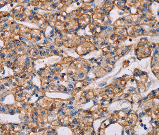 ARAP1 Polyclonal Antibody (E-AB-12988)