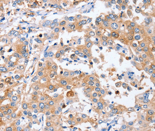 PPOX Polyclonal Antibody (E-AB-13533)