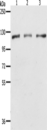 PARP1 Polyclonal Antibody (E-AB-16025)