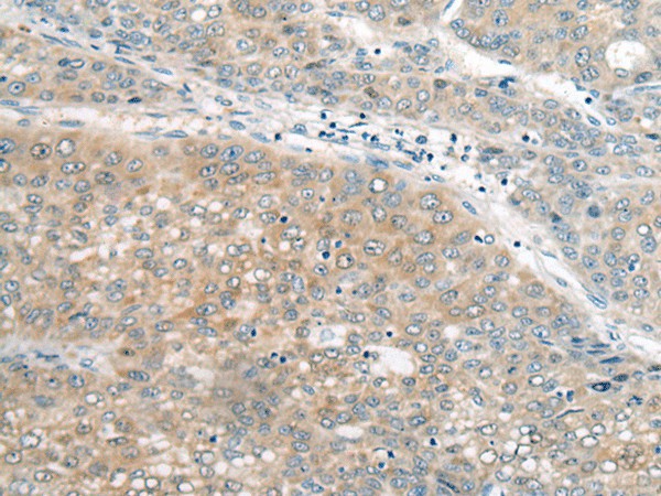 UBE2G2 Polyclonal Antibody (E-AB-18502)