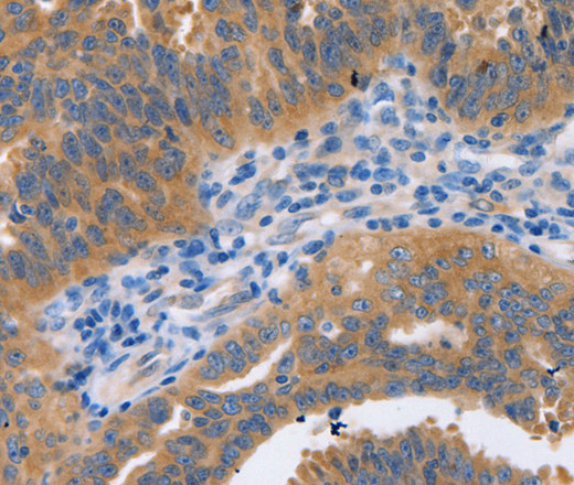 NBEA Polyclonal Antibody (E-AB-12593)