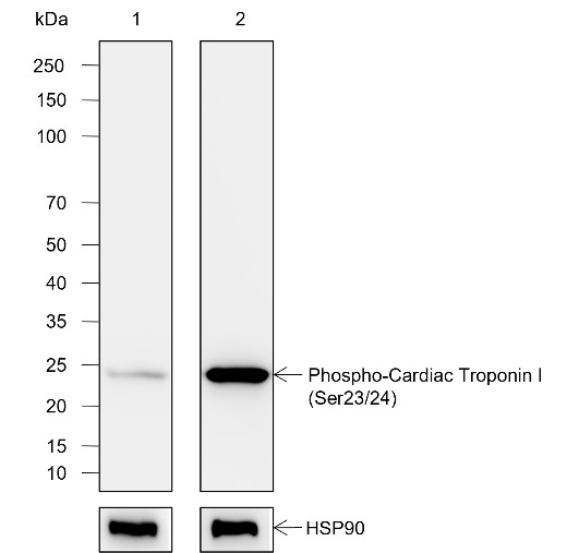 Recombinant Phospho-Cardiac Troponin I (Ser23, Ser24) Monoclonal Antibody (AN302104L)