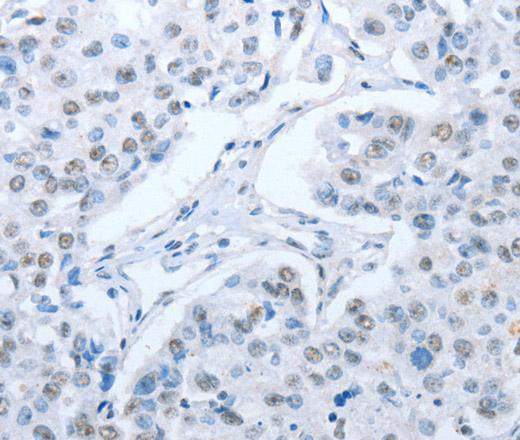 ARHGEF2 Polyclonal Antibody (E-AB-14606)