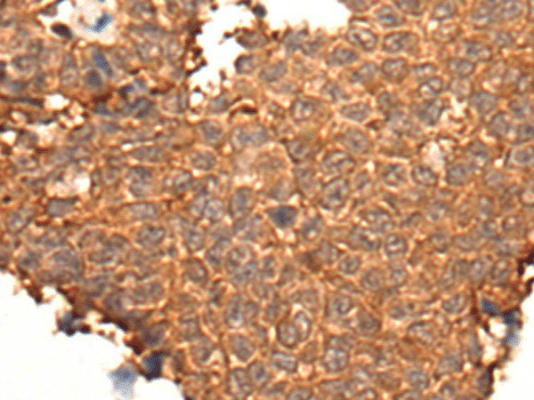 HOXD8 Polyclonal Antibody (E-AB-19416)